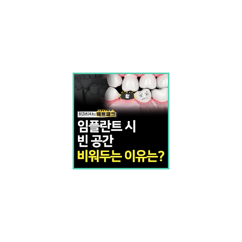 어금니 임플란트 부작용, 미리예방! 관련 이미지 6