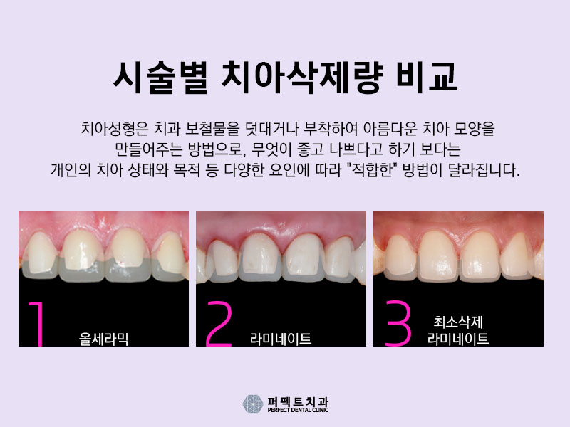 잃어버린 미소를 되찾는 치아성형! 관련 이미지 1