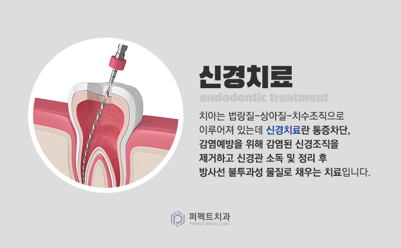 라미네이트시 신경치료 안해도 잇몸이 까매지나요? 관련 이미지 2