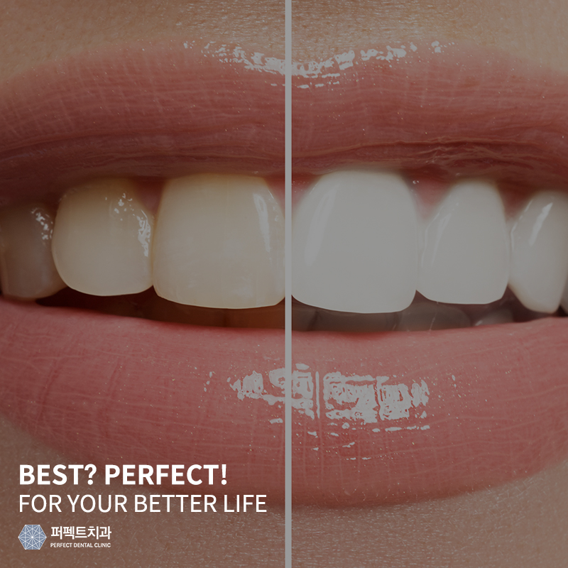 실활치 미백 과정과 주의사항 관련 이미지 1