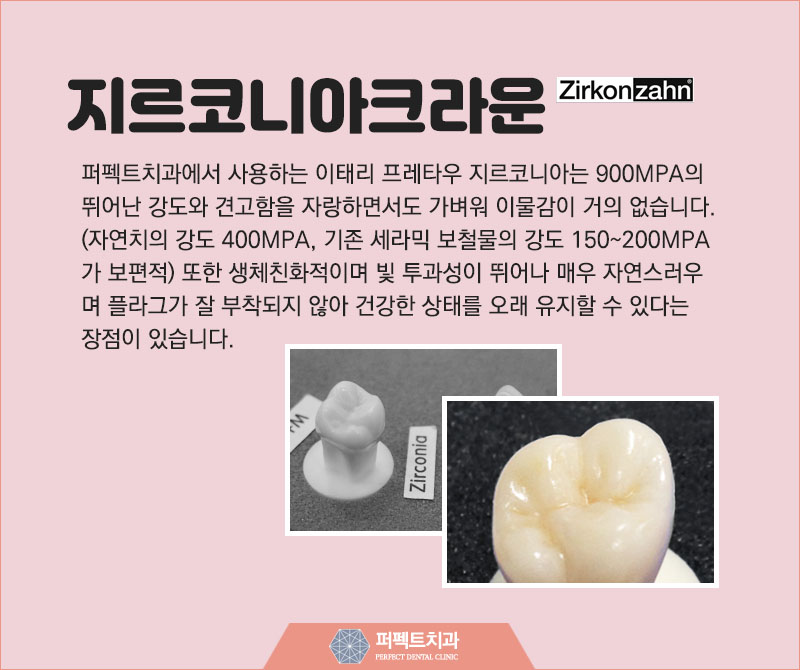 지르코니아 크라운 저렴하게 관련 이미지 2