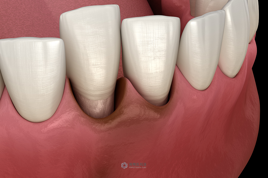 시린이의 원인 어떤 게 있을까? 관련 이미지 3