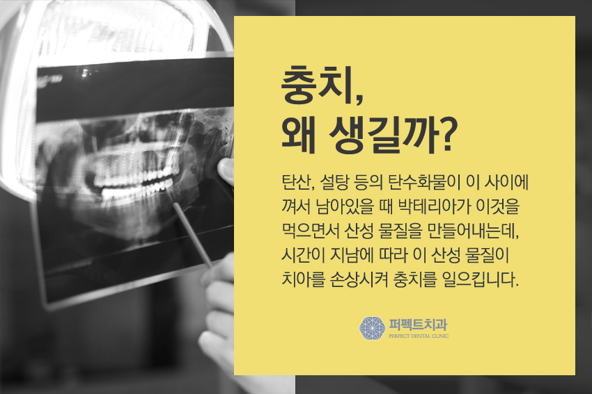 선릉역치과 충치치료 잘하는곳! 관련 이미지 3