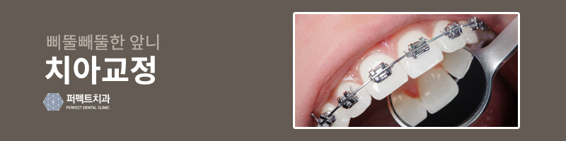 좋은 첫인상을 위한 앞니 치료법!! 관련 이미지 2
