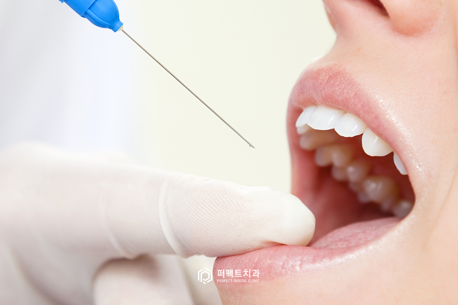 무통마취기는 통증이 하나도 없을까? 관련 이미지 4