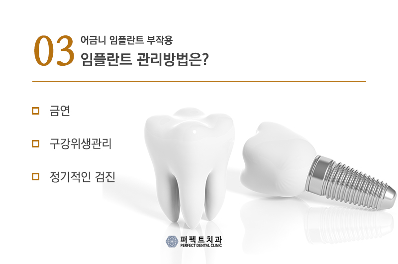 어금니 임플란트 부작용 증상 관련 이미지 5