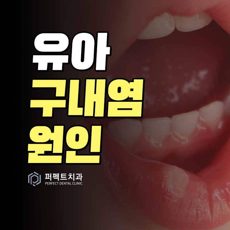 유아 구내염 원인 및 예방법 관련 이미지 1
