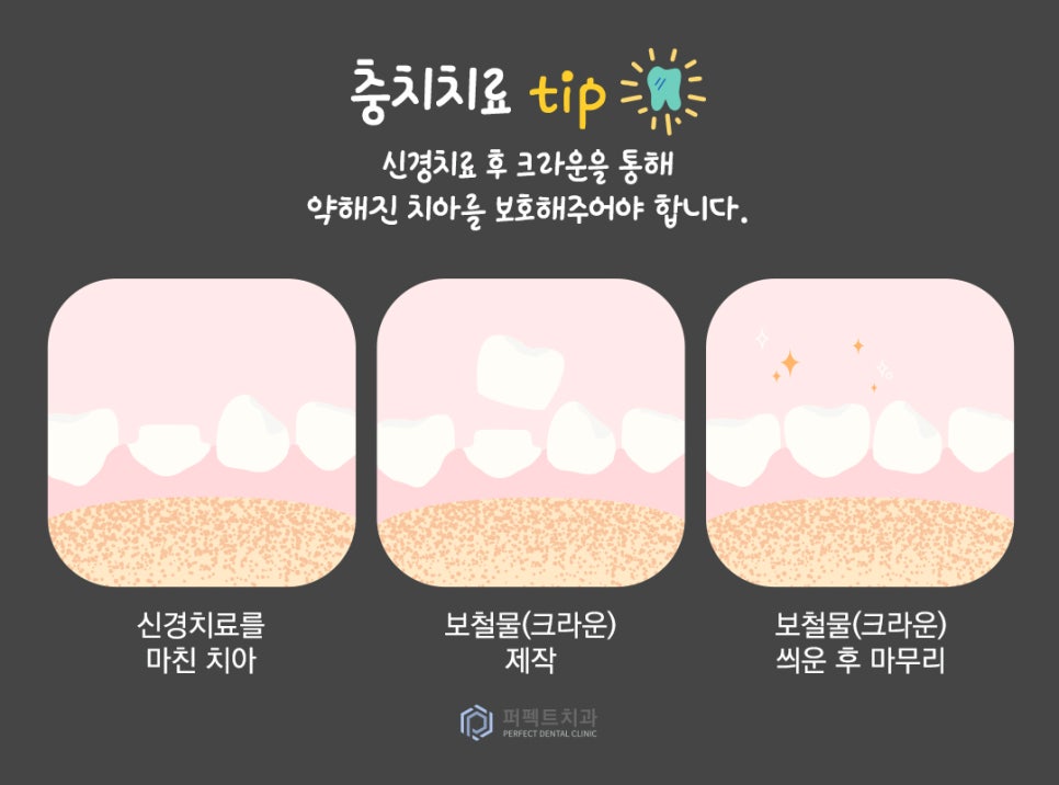 미룰수록 어려운 충치치료, 초기에 치료해요! 관련 이미지 8