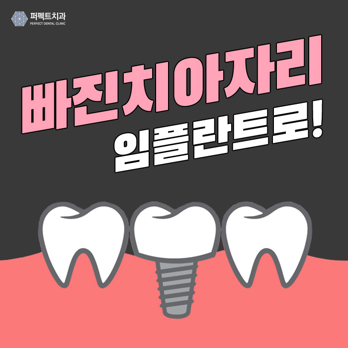 빠진치아 자리에? 임플란트 수술로! 관련 이미지 1