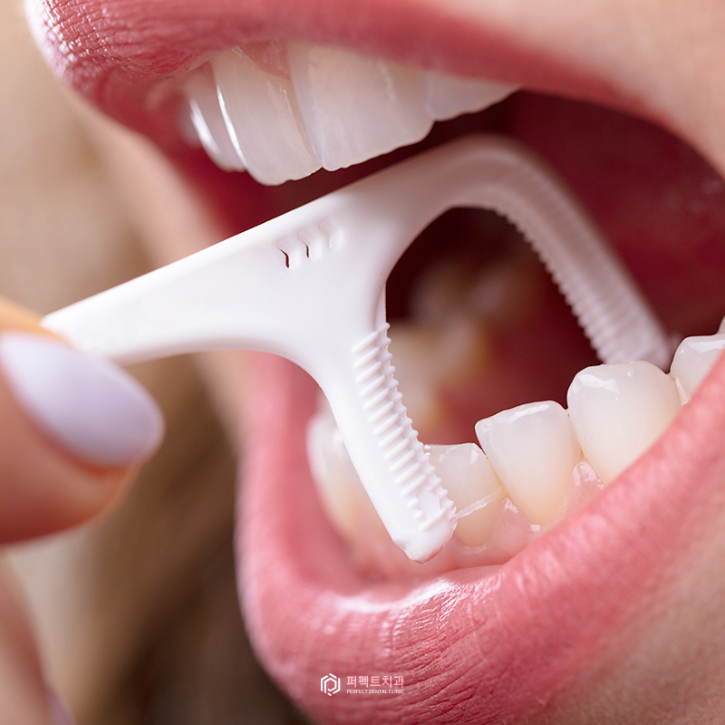 임플란트 상실로 이어질 수 있는 주위염 예방하세요! 관련 이미지 5