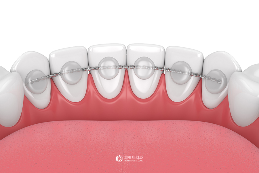 치료해도 자꾸 벌어지는 치아..😨 원인은? 관련 이미지 5
