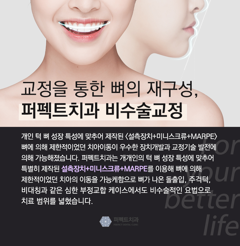 성인 앞니부분교정 관련 이미지 6
