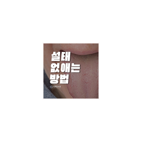 설태 생기는 이유와 없애는 방법 관련 이미지 5