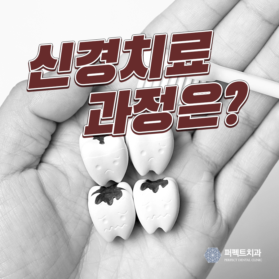신경치료 과정 겁내지 말고! 관련 이미지 2