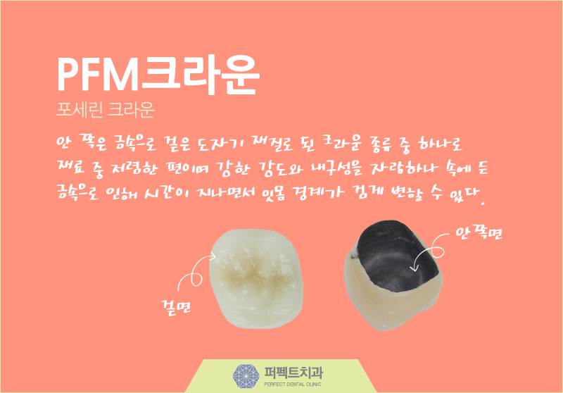 다시돌아온 지르코니아 크라운! 관련 이미지 3