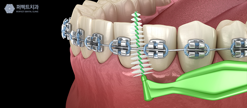 치실, 치간칫솔 사용법! 관련 이미지 2