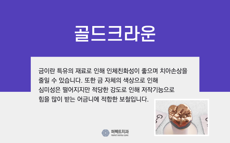 5월 프로모션 진행중인 ▶ 지르코니아 크라운! 관련 이미지 5