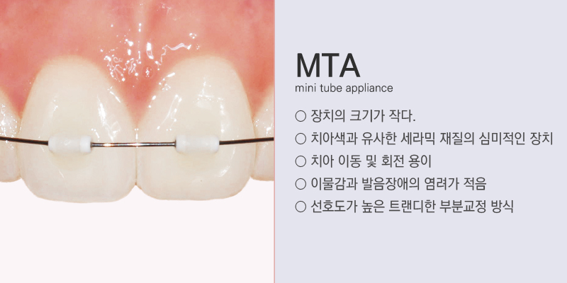 부분교정 믿고 맡길 수 있는 치과! 관련 이미지 3
