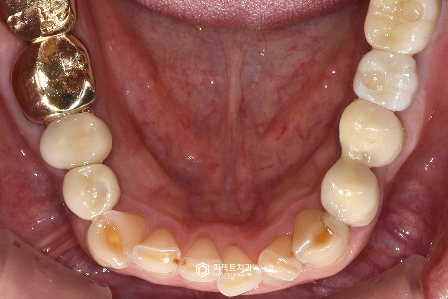 어금니가 없어 앞니로 음식을 드셨던..😰 어떻게 변했을까? 관련 이미지 13