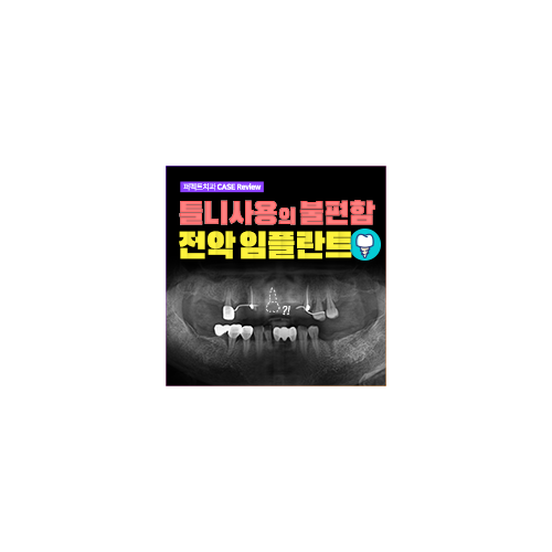 강남 임플란트 잘하는 곳 관련 이미지 4