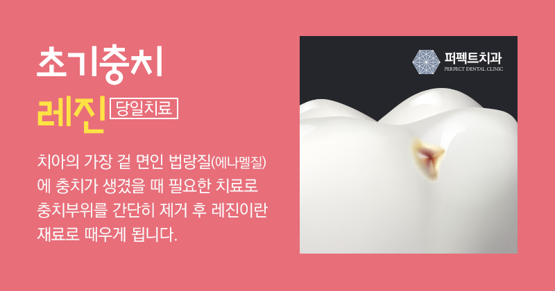 선릉 충치치료 인레이 알아보기! 관련 이미지 6