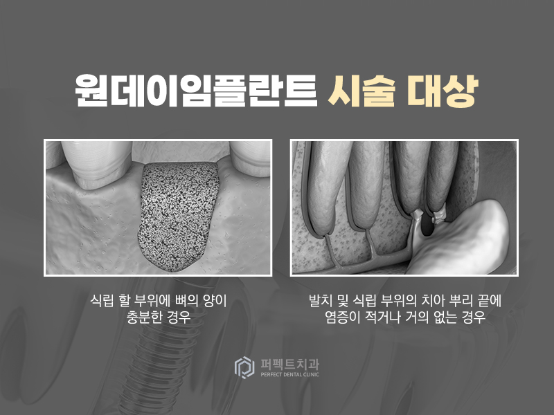 발치 즉시 식립하는 원데이 임플란트! 관련 이미지 3