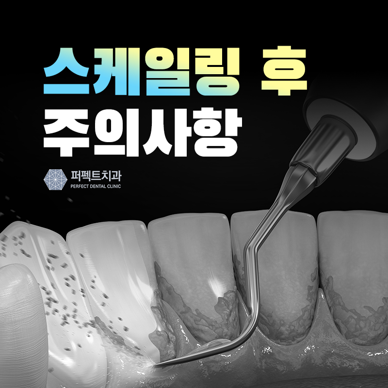 스케일링 후 주의사항과 오해 관련 이미지 1