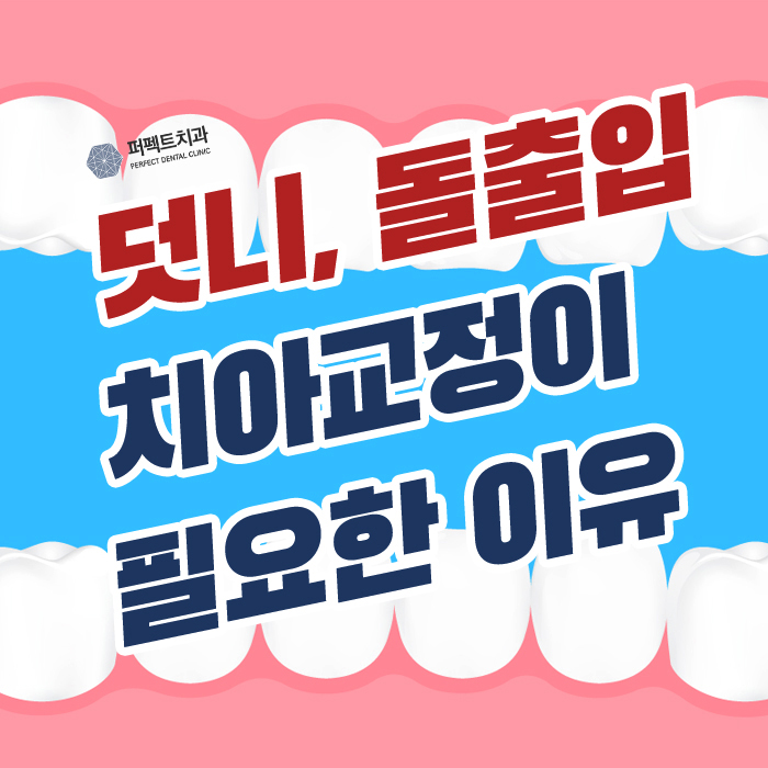 덧니와 돌출입,  치아교정이 필요한 이유 관련 이미지 1