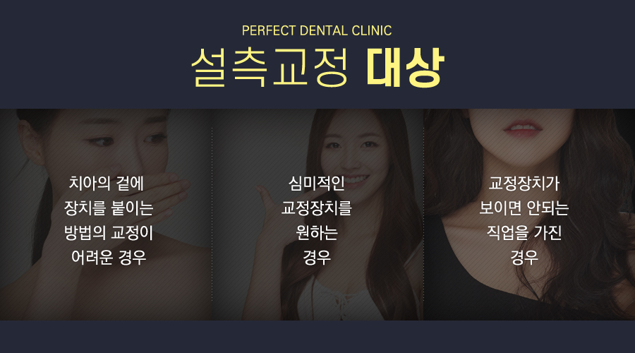 치아안쪽에 부착하는 설측교정! 관련 이미지 8