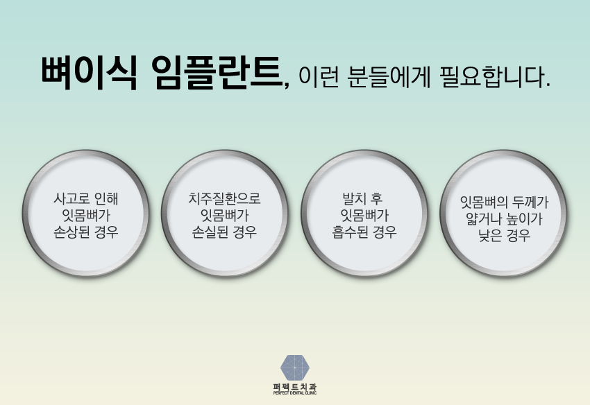 내가 뼈이식임플란트를 해야된다고? 관련 이미지 3