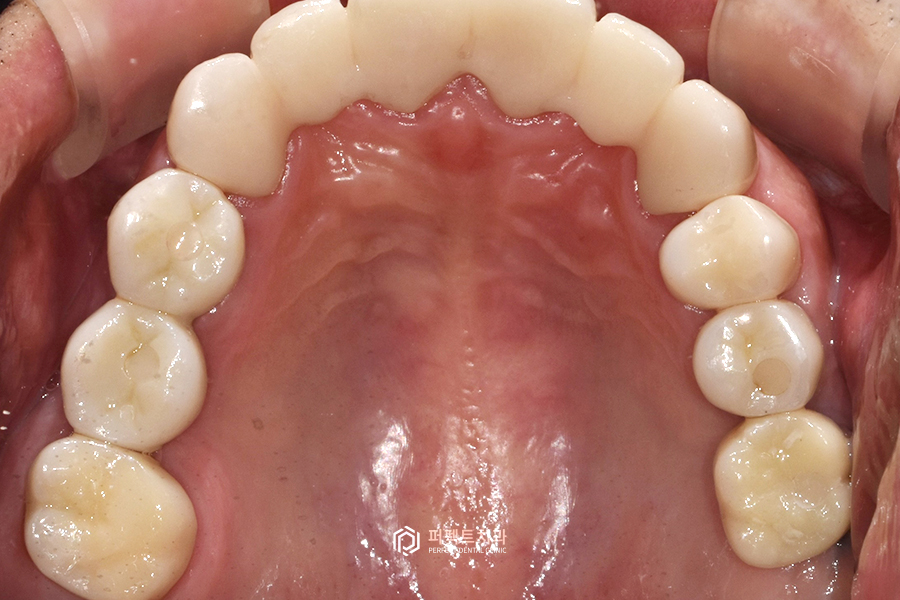 어금니가 없어 앞니로 음식을 드셨던..😰 어떻게 변했을까? 관련 이미지 11