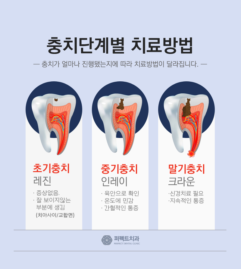 직장인 충치, 버티지말고 야간진료로 치료하세요 관련 이미지 3