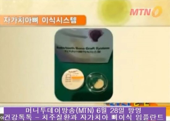 MTN 건강톡톡 방송장면^^ 관련 이미지 3