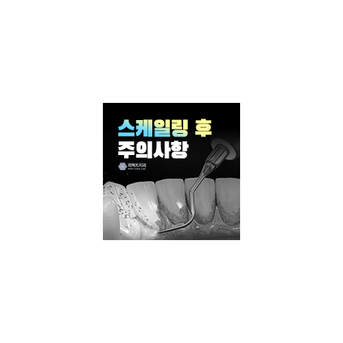 스케일링 후 주의사항과 오해 관련 이미지 6