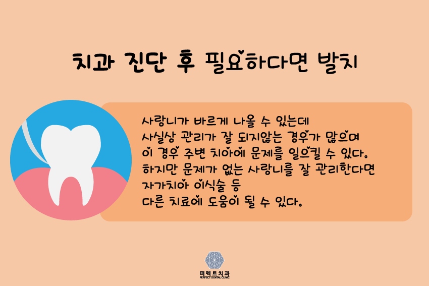 사랑니 뽑아야 되는데 아플까?ㅠㅠ 관련 이미지 5