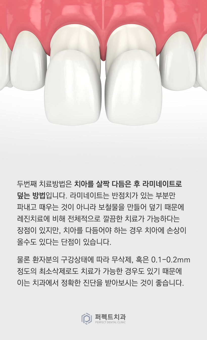 앞니 반점치는 어떻게 치료하나요? 관련 이미지 4
