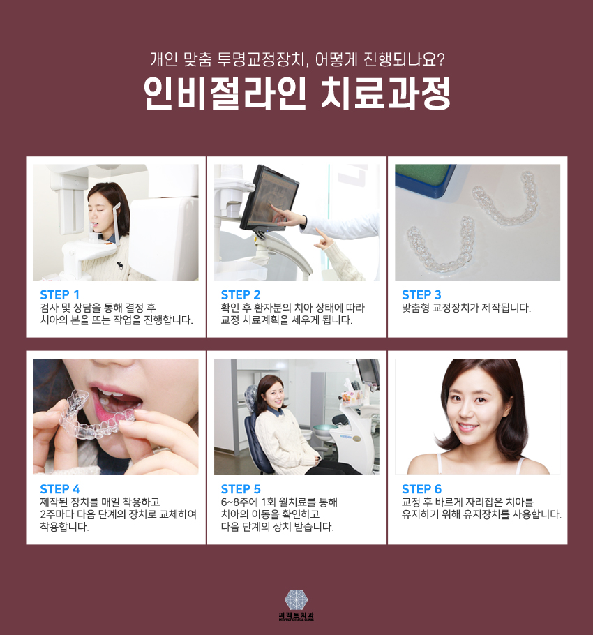 투명교정 원한다면 인비절라인! 관련 이미지 5