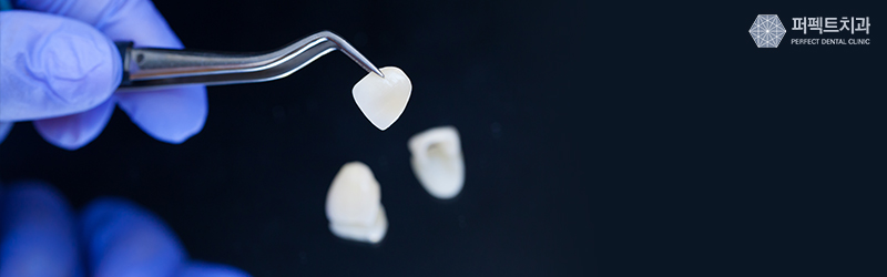 떨어진 라미네이트 재시술 가능? 관련 이미지 6