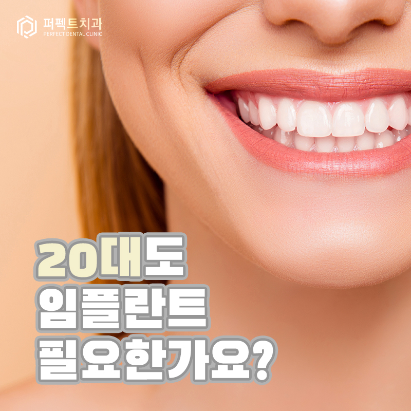 20대도 임플란트가 필요한가요? 관련 이미지 1