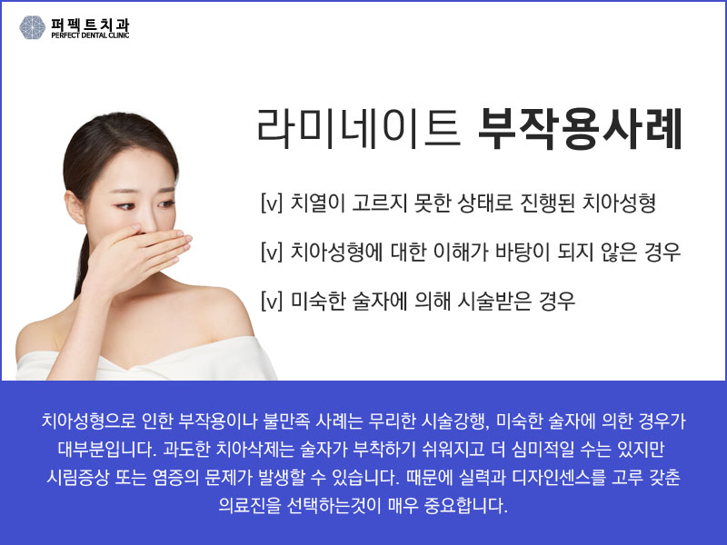 넌 앞니라미네이트 어디서하니? 관련 이미지 4