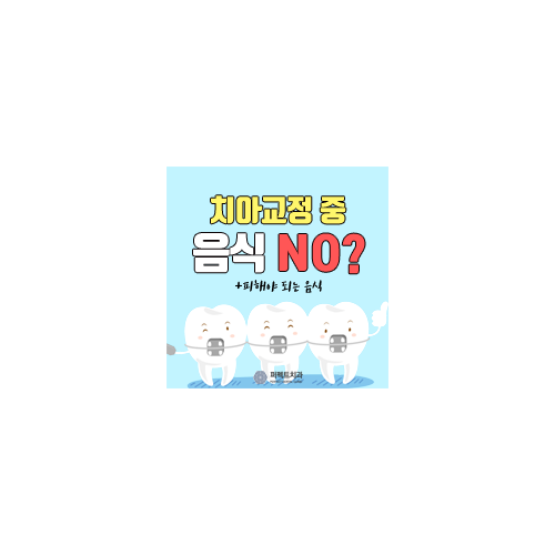 치아교정 음식, 어떤거 피하라고? 관련 이미지 6