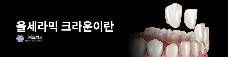 강남역치과 크라운 치료 가격 관련 이미지 4