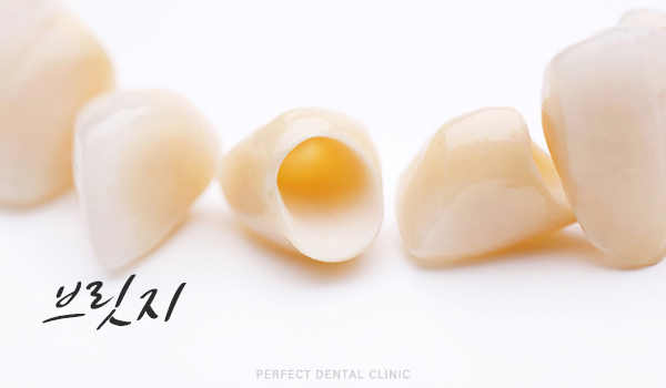 상실한 치아 어떻게 해야하나? 관련 이미지 2