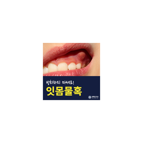 잇몸물혹 방치하게 되면? 관련 이미지 6