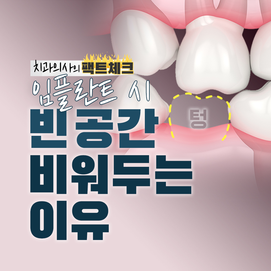 임플란트 후, 발치된 빈 공간이 걱정된다면? 관련 이미지 8