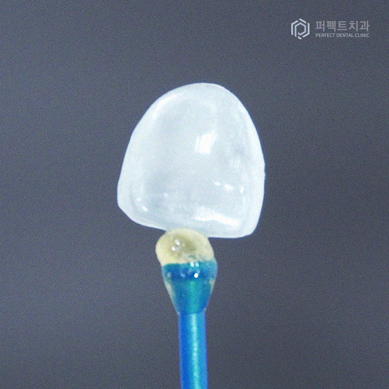 라미네이트는 무조건 얇을 게 좋을까? 관련 이미지 2