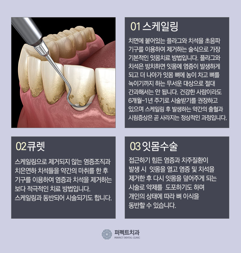 이시림 증상과 통증에 대해 알아보자! 관련 이미지 6