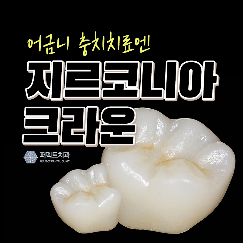 충치치료 지르코니아 크라운 가격! 관련 이미지 1