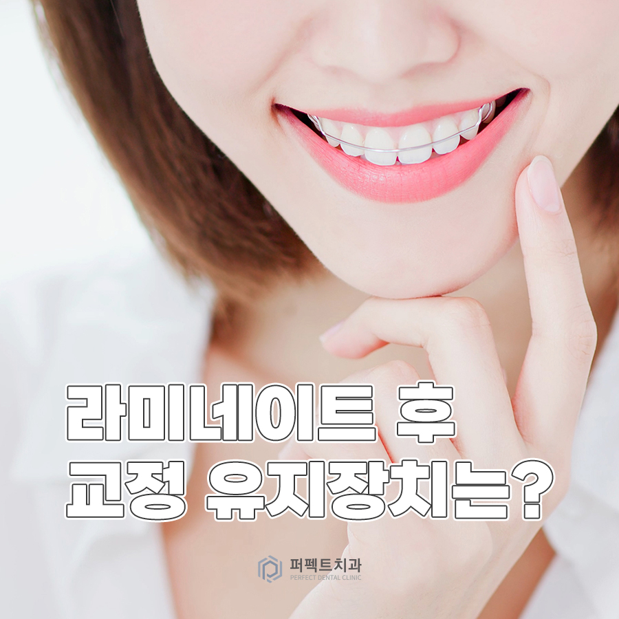 라미네이트 후 교정 유지장치는? 관련 이미지 1