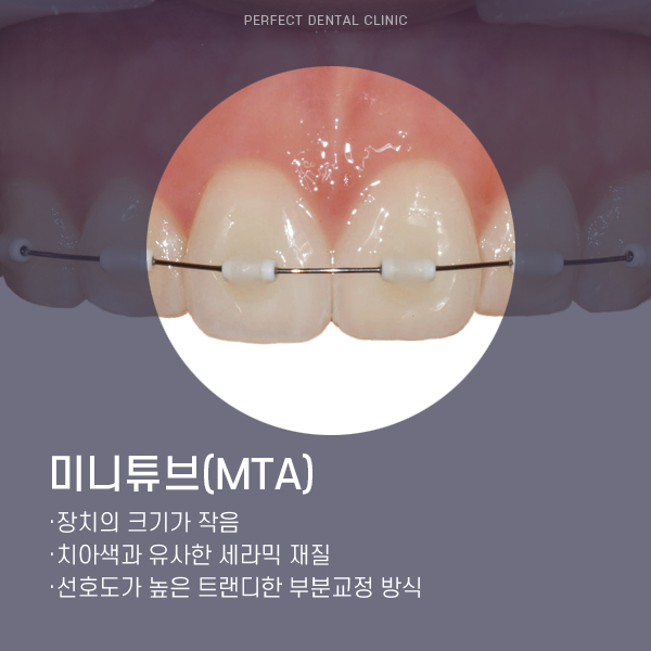 부분교정 찾는 사람들은 주목! 관련 이미지 3